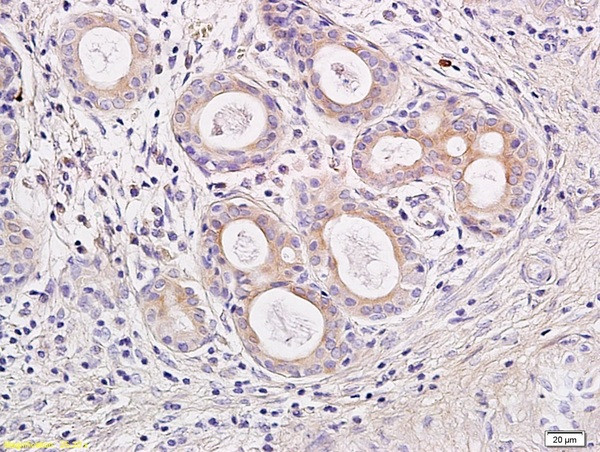 IL-23 Antibody in Immunohistochemistry (Paraffin) (IHC (P))