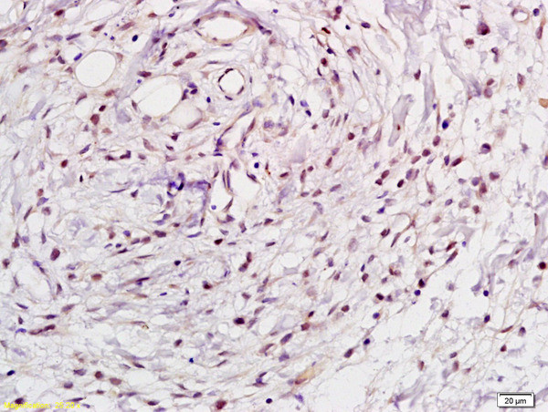 NFkB p105/p50 Antibody in Immunohistochemistry (Paraffin) (IHC (P))