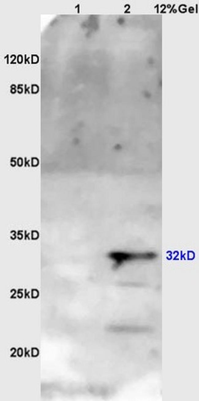 OTX1 + OTX2 Antibody in Western Blot (WB)