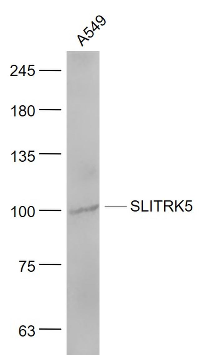 SLITRK5 Antibody in Western Blot (WB)