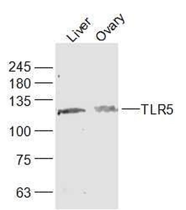 TLR5 Antibody in Western Blot (WB)