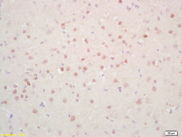 Phosphoserine/threonine/tyrosine Antibody in Immunohistochemistry (Paraffin) (IHC (P))