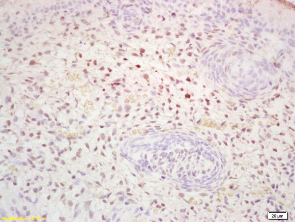 Phosphoserine/threonine/tyrosine Antibody in Immunohistochemistry (Paraffin) (IHC (P))