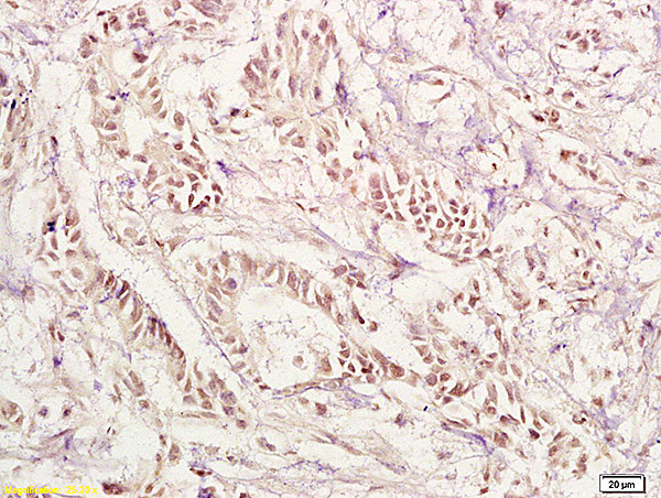 PAX1 Antibody in Immunohistochemistry (Paraffin) (IHC (P))