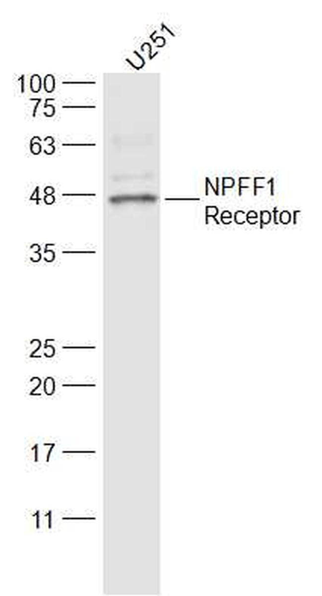 GPR147/NPFF1 Receptor Antibody in Western Blot (WB)