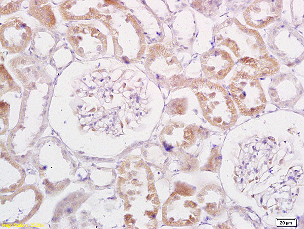 TRADD Antibody in Immunohistochemistry (Paraffin) (IHC (P))