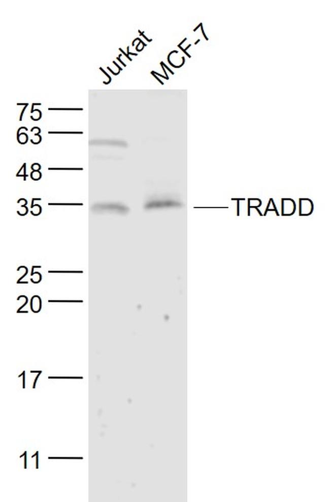 TRADD Antibody in Western Blot (WB)