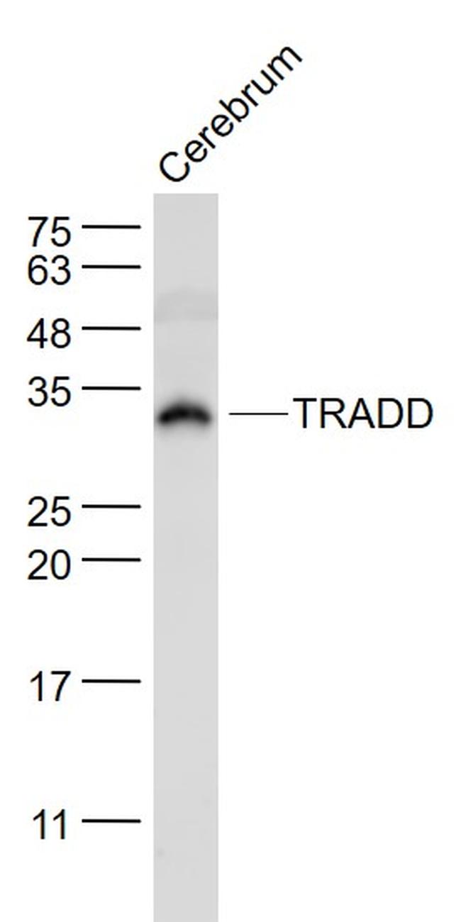 TRADD Antibody in Western Blot (WB)