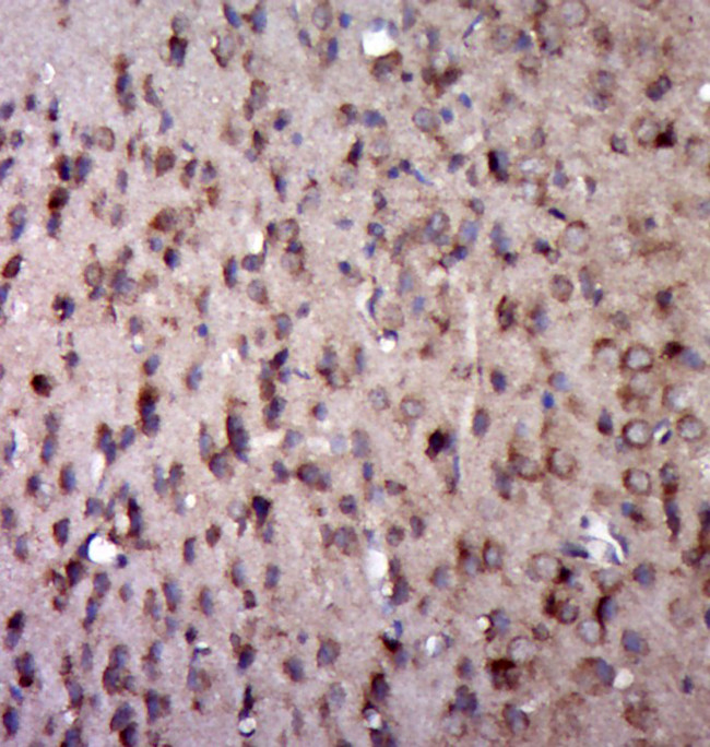 5HT2A Receptor/SR-2A Antibody in Immunohistochemistry (Paraffin) (IHC (P))