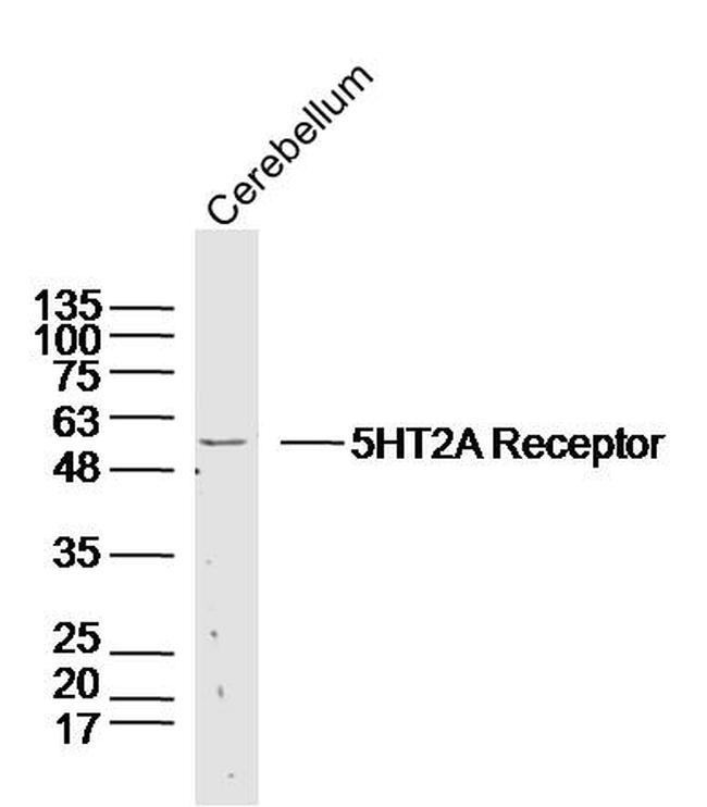 5HT2A Receptor/SR-2A Antibody in Western Blot (WB)