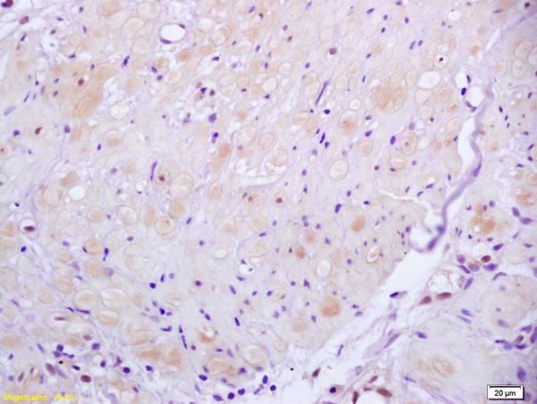 ROCK2 Antibody in Immunohistochemistry (Paraffin) (IHC (P))