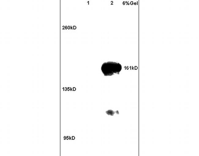 ROCK2 Antibody in Western Blot (WB)