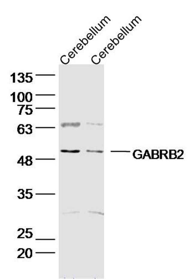 GABRB2/GABA A Receptor beta 2 Antibody in Western Blot (WB)