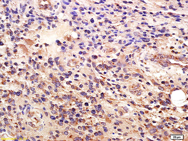 GLI1 Antibody in Immunohistochemistry (Paraffin) (IHC (P))