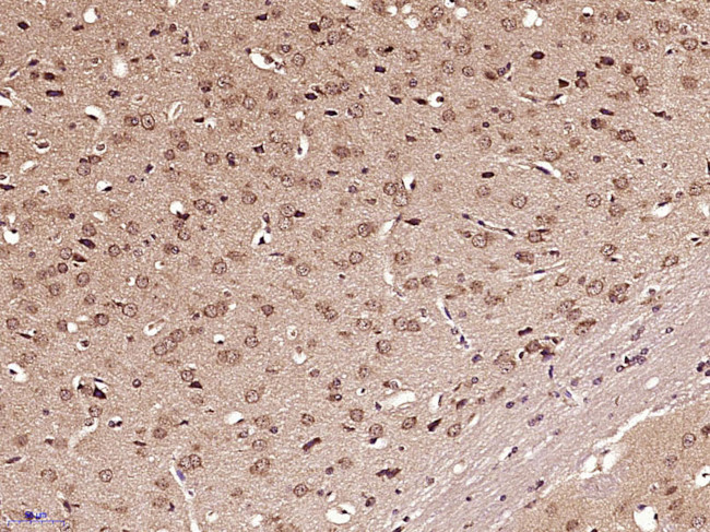 GLI1 Antibody in Immunohistochemistry (Paraffin) (IHC (P))