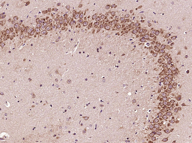 GLI1 Antibody in Immunohistochemistry (Paraffin) (IHC (P))