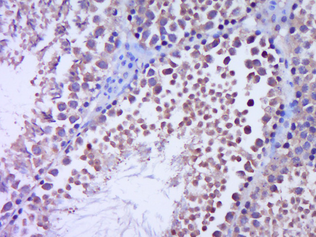 GLI1 Antibody in Immunohistochemistry (Paraffin) (IHC (P))