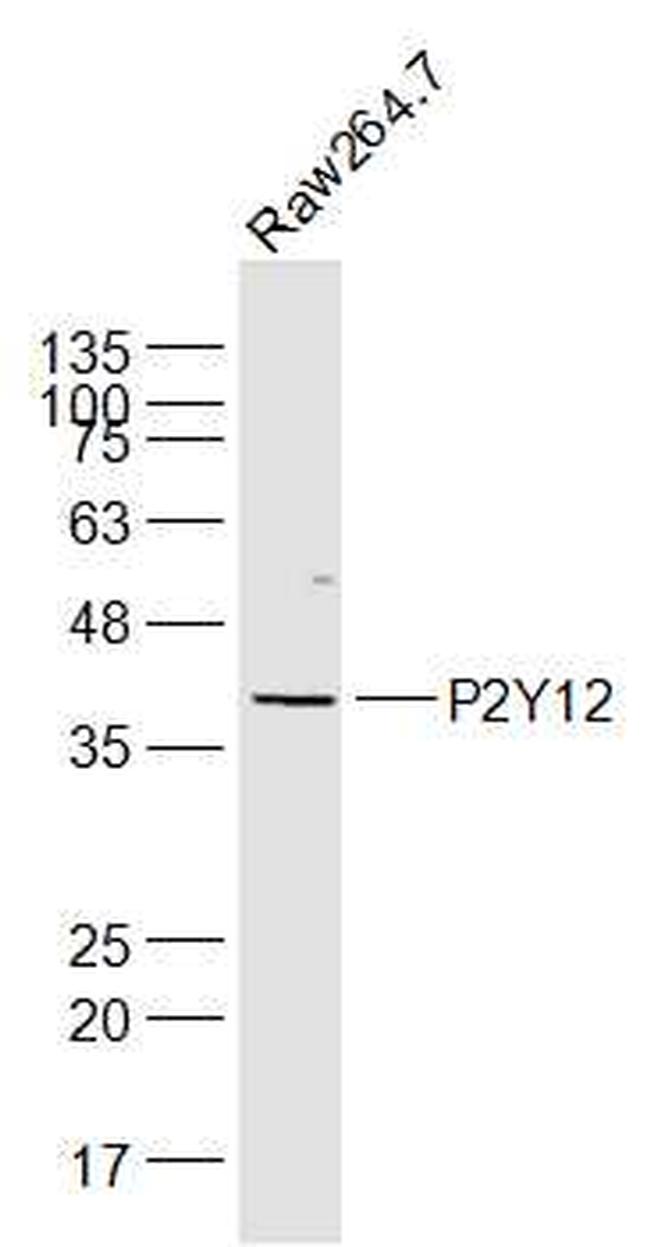 P2Y12 Antibody in Western Blot (WB)