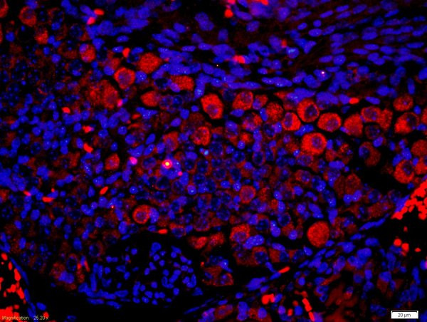 P2Y9 Antibody in Immunohistochemistry (Paraffin) (IHC (P))