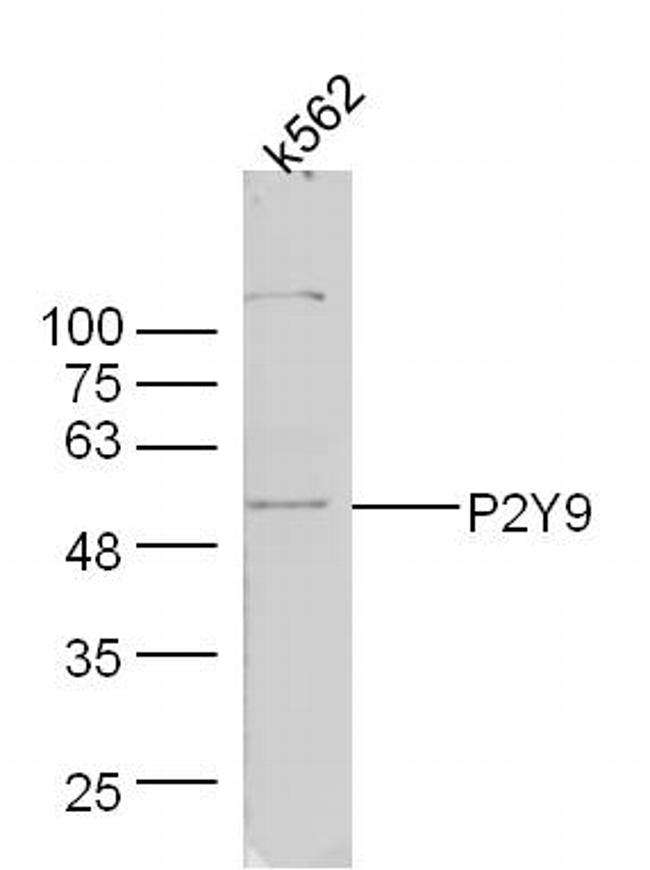 P2Y9 Antibody in Western Blot (WB)