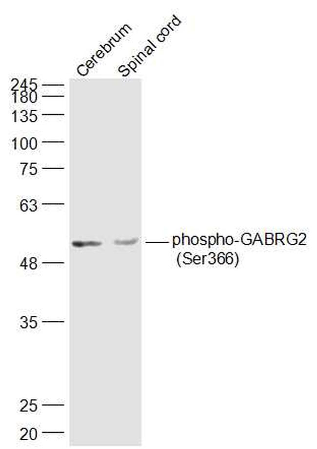 Phospho-GABRG2 (Ser366) Antibody in Western Blot (WB)