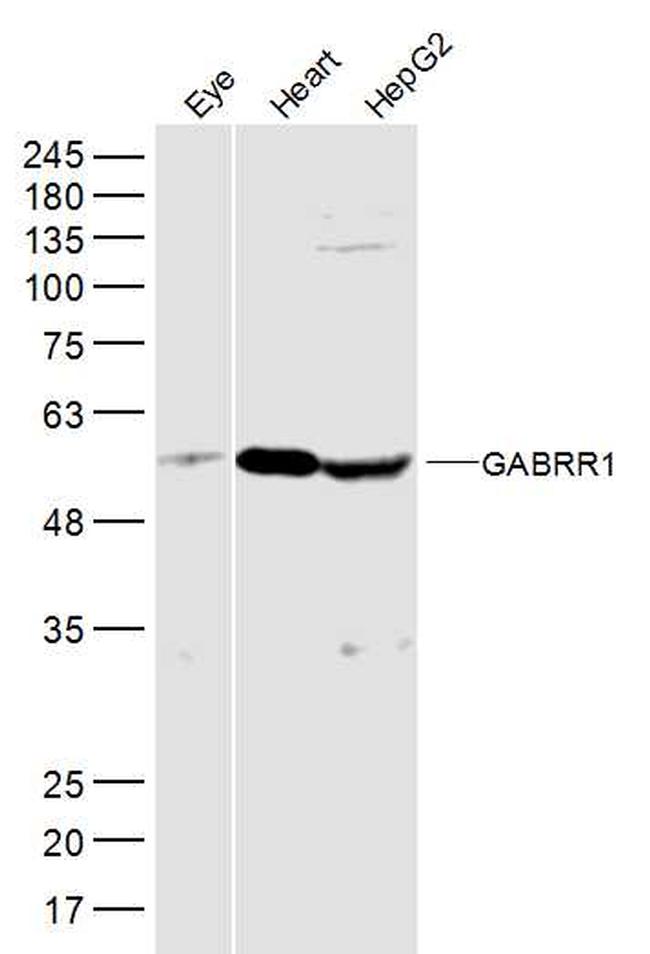 GABRR1 Antibody in Western Blot (WB)