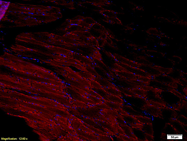 ADAMTS1 Antibody in Immunohistochemistry (Paraffin) (IHC (P))