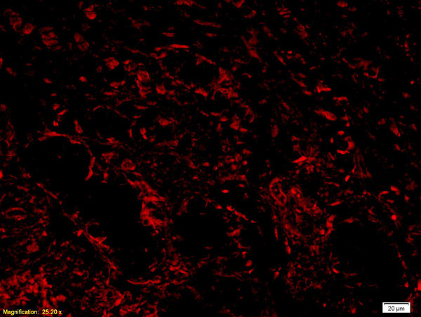 ADAMTS1 Antibody in Immunohistochemistry (Paraffin) (IHC (P))