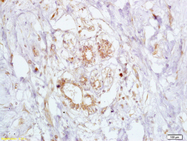 BRCA2 Antibody in Immunohistochemistry (Paraffin) (IHC (P))