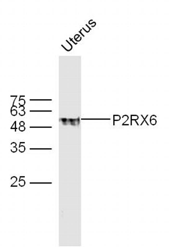 P2RX6 Antibody in Western Blot (WB)