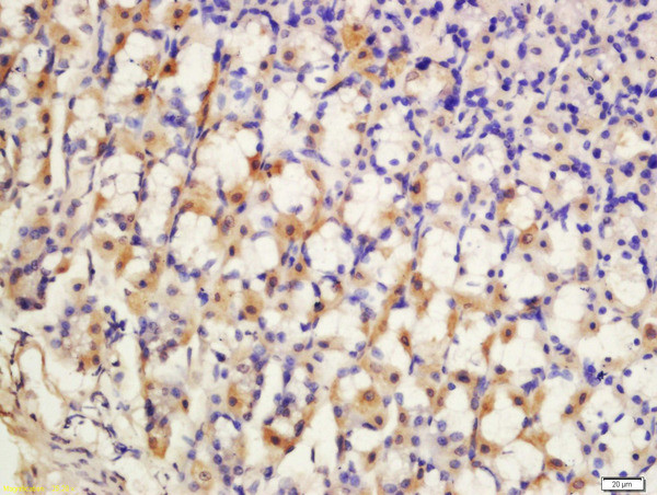 SCN7A Antibody in Immunohistochemistry (Paraffin) (IHC (P))