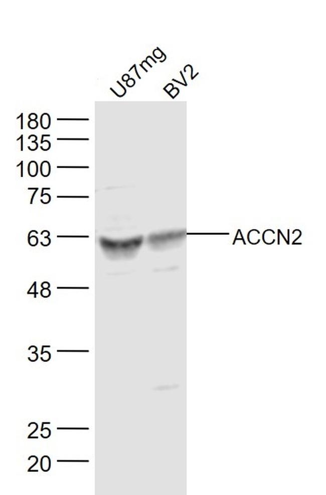 ACCN2 Antibody in Western Blot (WB)