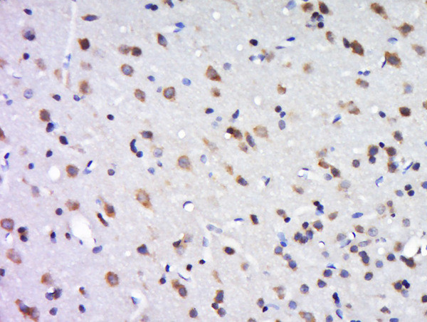 SAPAP2/DLGAP2 Antibody in Immunohistochemistry (Paraffin) (IHC (P))