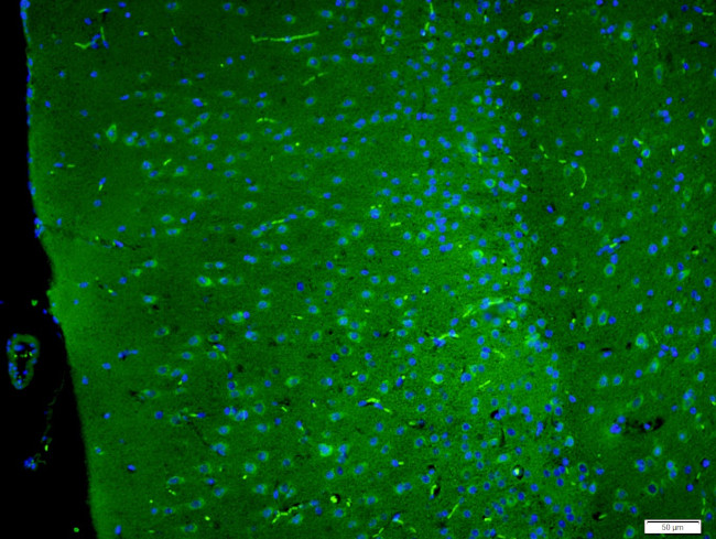 SAPAP4/DLGAP4 Antibody in Immunohistochemistry (Paraffin) (IHC (P))