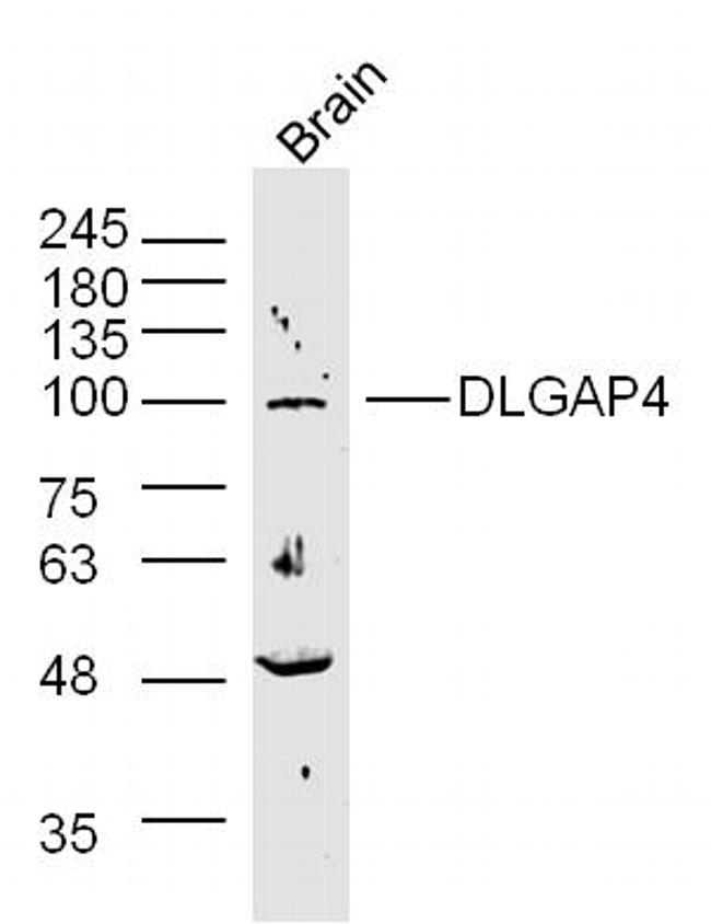 SAPAP4/DLGAP4 Antibody in Western Blot (WB)