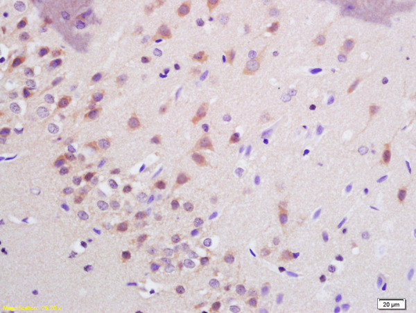 SHANK3 Antibody in Immunohistochemistry (Paraffin) (IHC (P))