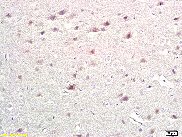 Tryptophan 5-hydroxylase 1, Tryptophan 5-hydroxylase 2 Antibody in Immunohistochemistry (Paraffin) (IHC (P))