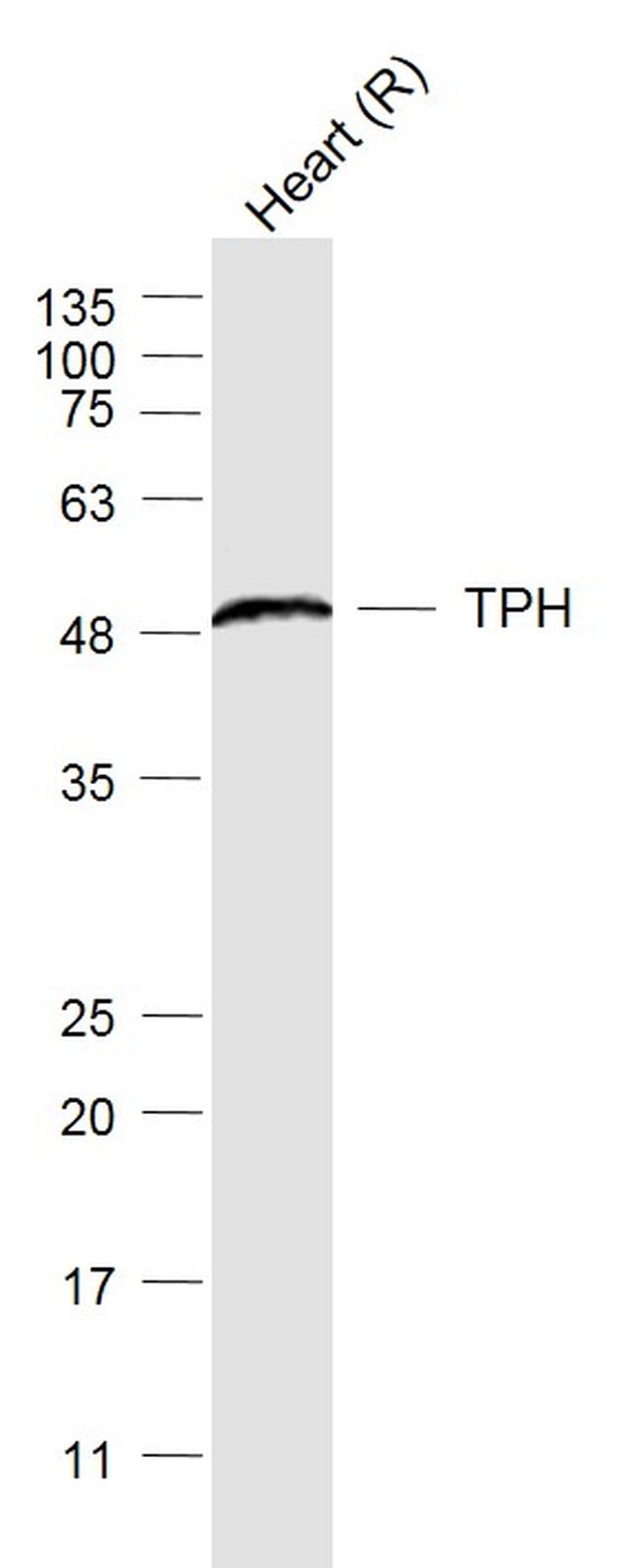 Tryptophan 5-hydroxylase 1, Tryptophan 5-hydroxylase 2 Antibody in Western Blot (WB)