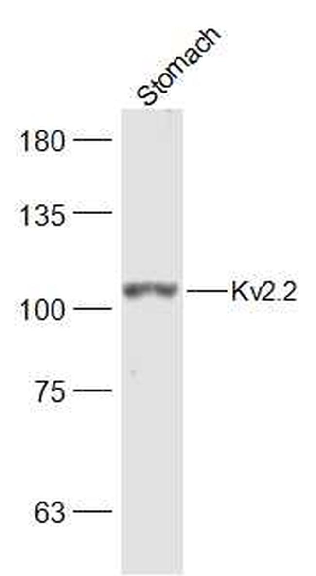 Kv2.2 Antibody in Western Blot (WB)