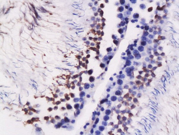 GRP78 Antibody in Immunohistochemistry (Paraffin) (IHC (P))