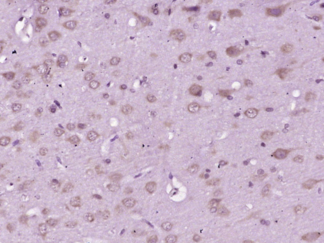 GRP78 Antibody in Immunohistochemistry (Paraffin) (IHC (P))