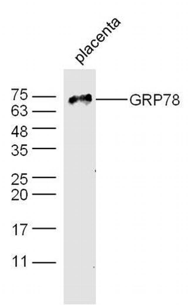 GRP78 Antibody in Western Blot (WB)