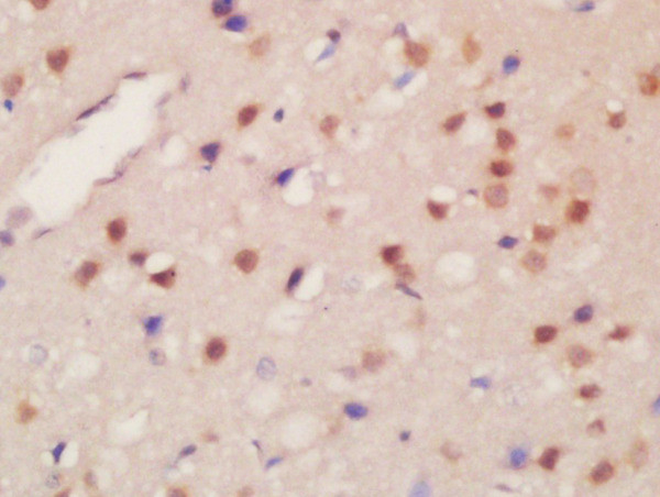 Phospho-JMJD2B (Thr305) Antibody in Immunohistochemistry (Paraffin) (IHC (P))