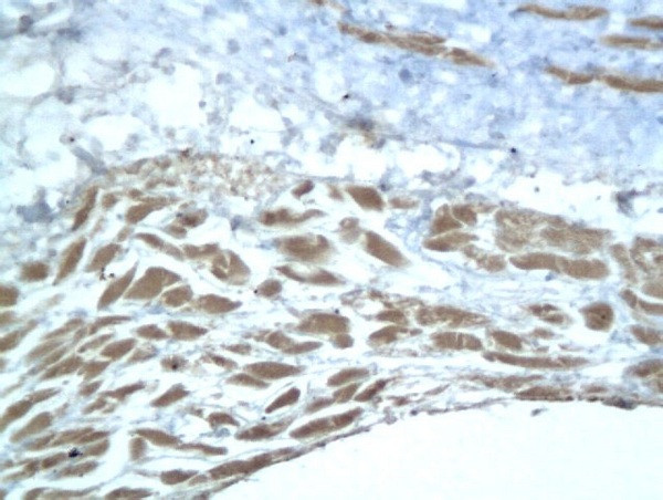 Aggrecan core protein 1 Antibody in Immunohistochemistry (Paraffin) (IHC (P))