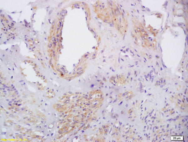 Phospho-CXCR4 (Ser339) Antibody in Immunohistochemistry (Paraffin) (IHC (P))