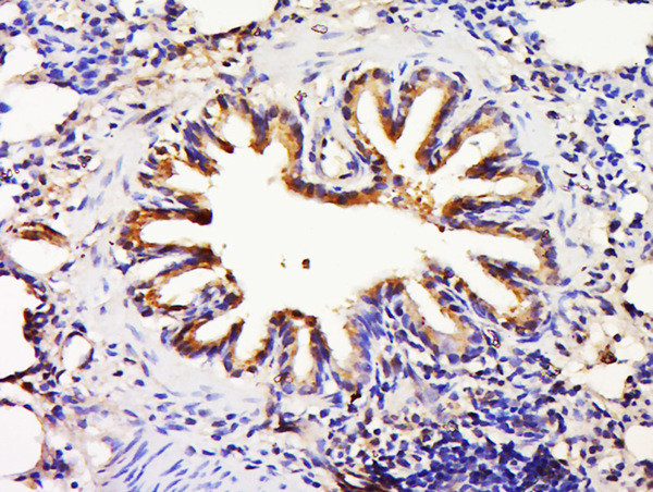 FTSJ1 Antibody in Immunohistochemistry (Paraffin) (IHC (P))