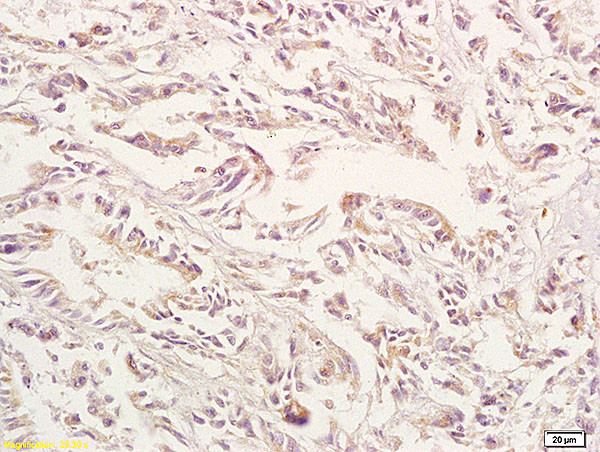 GPA33 Antibody in Immunohistochemistry (Paraffin) (IHC (P))