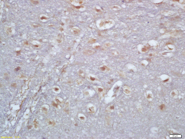 TBX6 Antibody in Immunohistochemistry (Paraffin) (IHC (P))