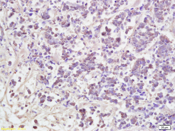 AATF Antibody in Immunohistochemistry (Paraffin) (IHC (P))