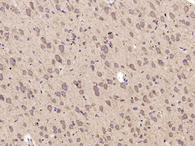 ABCG1 Antibody in Immunohistochemistry (Paraffin) (IHC (P))